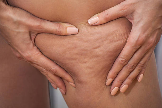 The Benefits of Using Gotu Kola for Cellulite Reduction